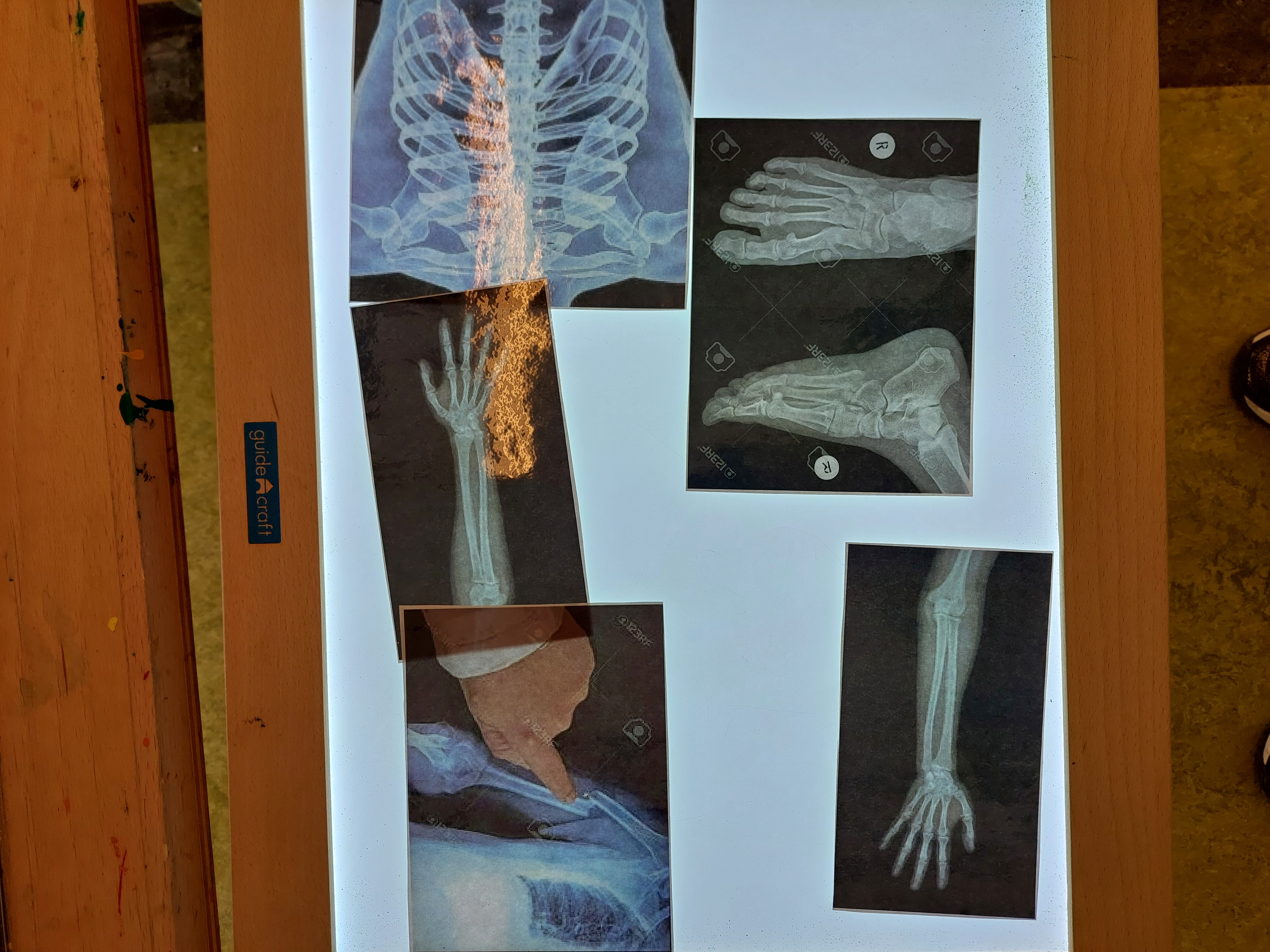 Thema: ik ga naar de dokter